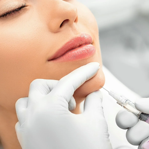 DERMAL FILLERS